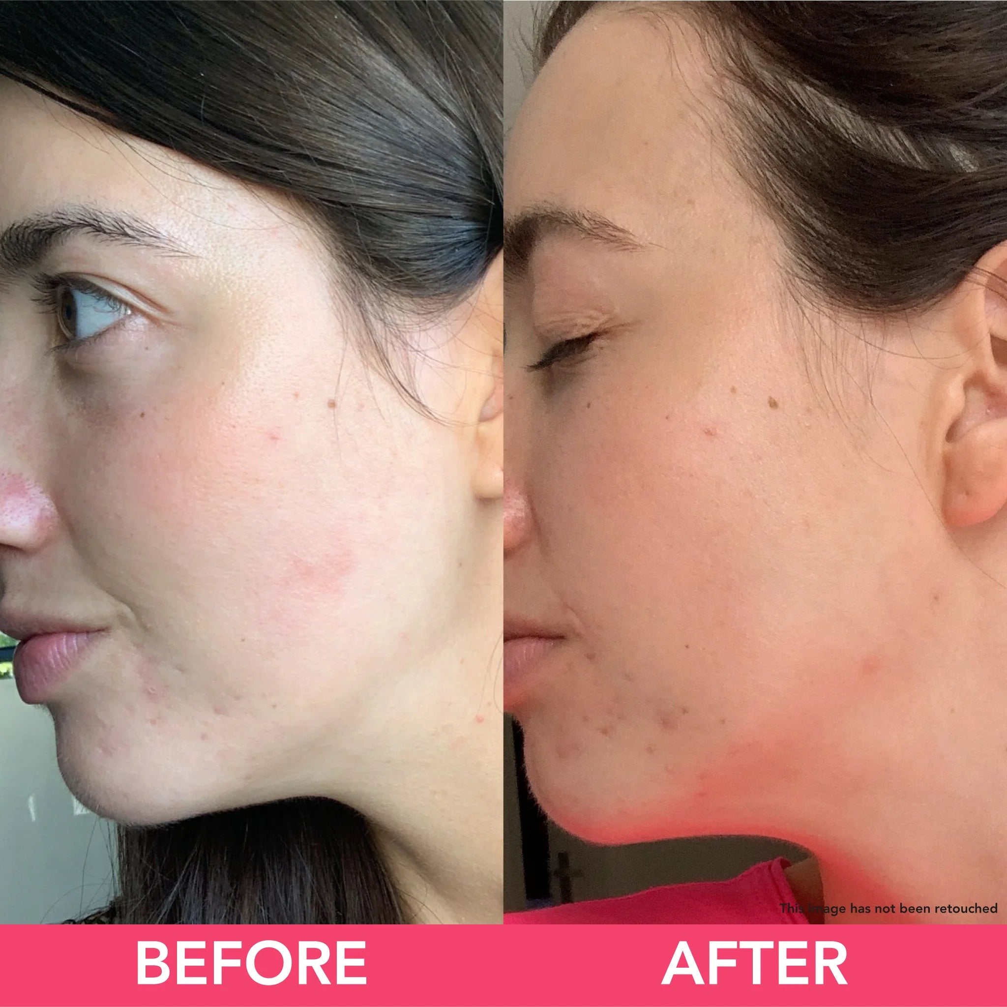 Aloe Vera Water Gel Cream – Lightweight Hydrating & Soothing Face Moisturizer