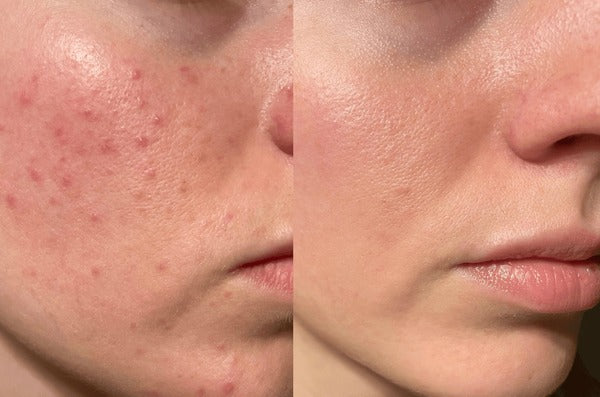 Damange skin Solutions